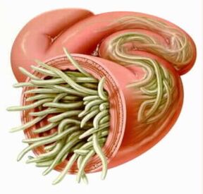 Parassiti nell'intestino