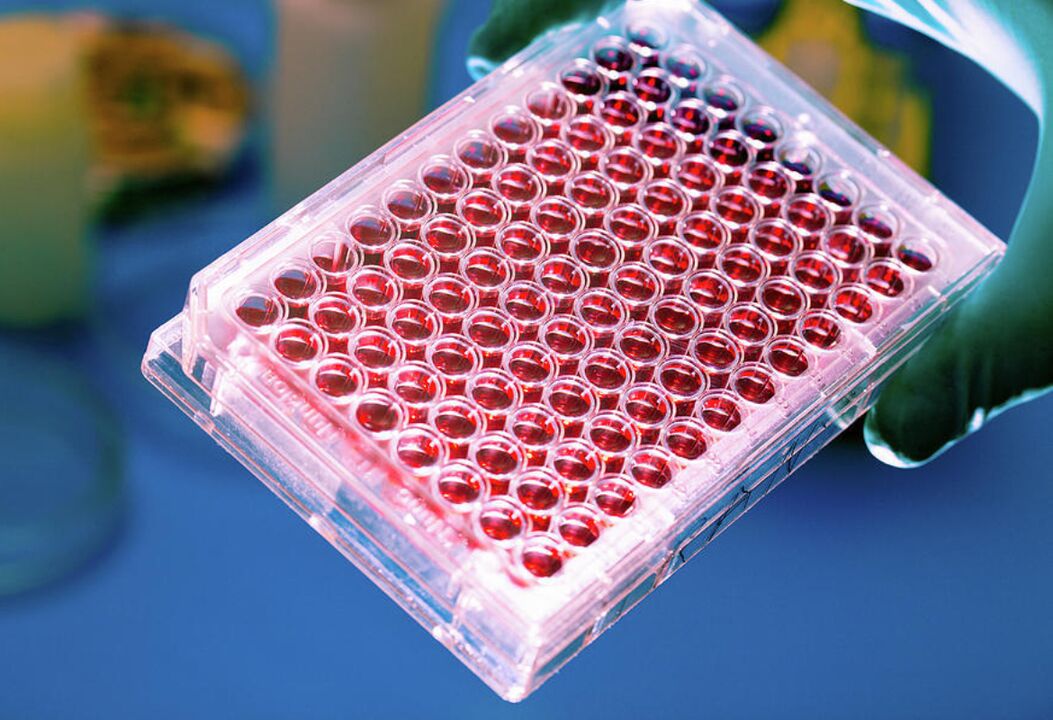 Esame del sangue per i parassiti