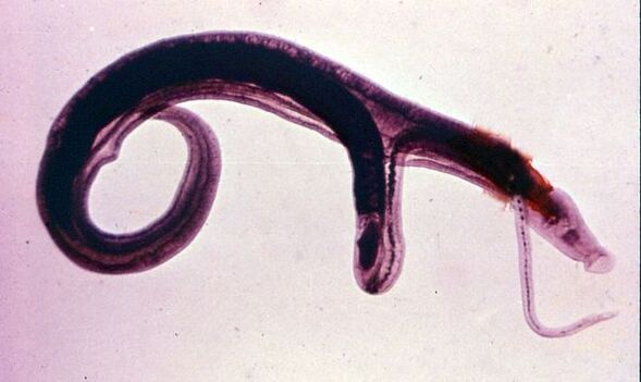 Gli schistosomi sono tra i parassiti più comuni e pericolosi